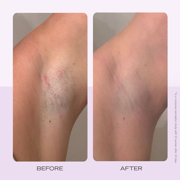 FIRST AID BEAUTY Диски від врослого волосся - Біорозкладні диски від врослого волосся 60 шт. 60 ДИСКИ 663690 фото