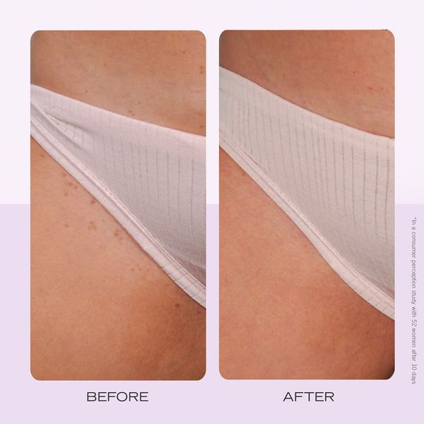FIRST AID BEAUTY Диски від врослого волосся - Біорозкладні диски від врослого волосся 60 шт. 60 ДИСКИ 663690 фото