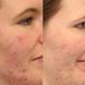 MURAD Очищуючий гель для обличчя 120800 фото 2