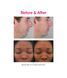 PMD Персональная микродерма Pro Blush Microdermabrasion 1 ПК. 80033068-C-80033068-1 фото 4